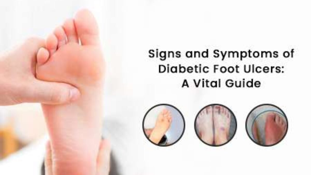 Signs and Symptoms of Diabetic Foot Ulcers A Vital Guide ...