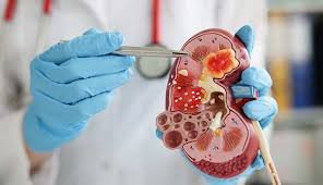 Best nephrology hospital in hyderabad