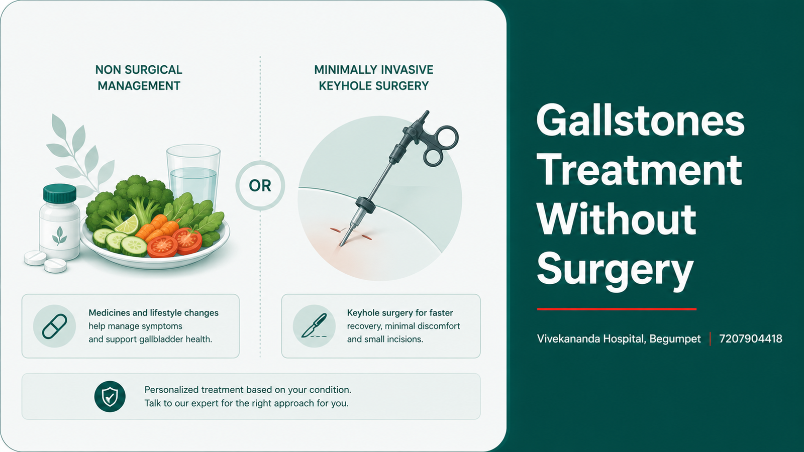 Gallstones treatment without surgery: dissolution medicine, diet and lifestyle, versus laparoscopic removal