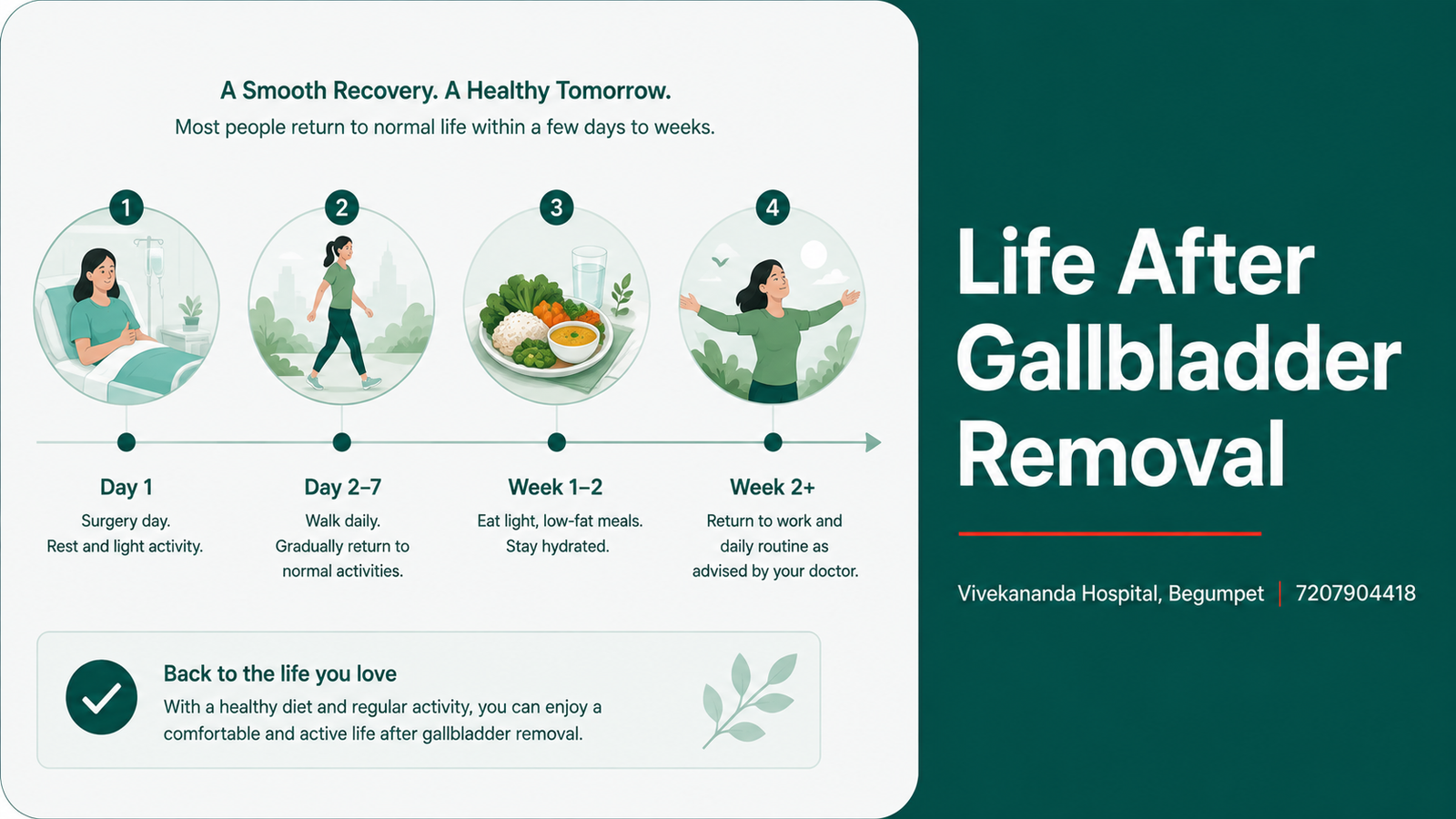 Life after gallbladder removal: recovery timeline, low-fat diet and return to normal activity